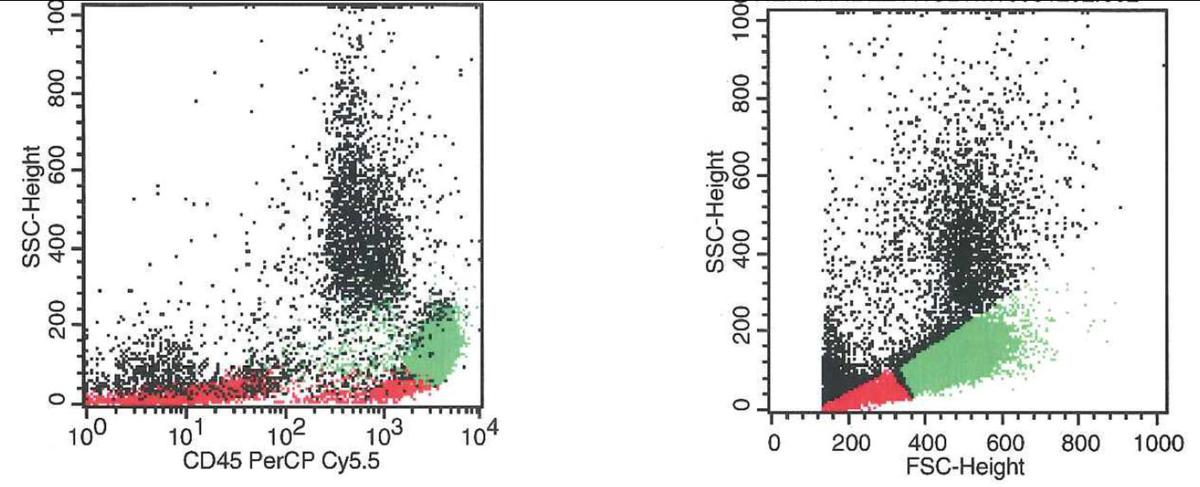 Flow cytometry showing a population of atypical lymphoid cells with increased forward scatter and side scatter characteristics (green)